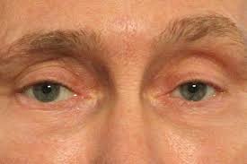 Eyes
